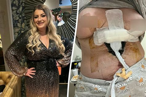 chloe turkey|Halifax woman 'can't thank people enough' after botched boob .